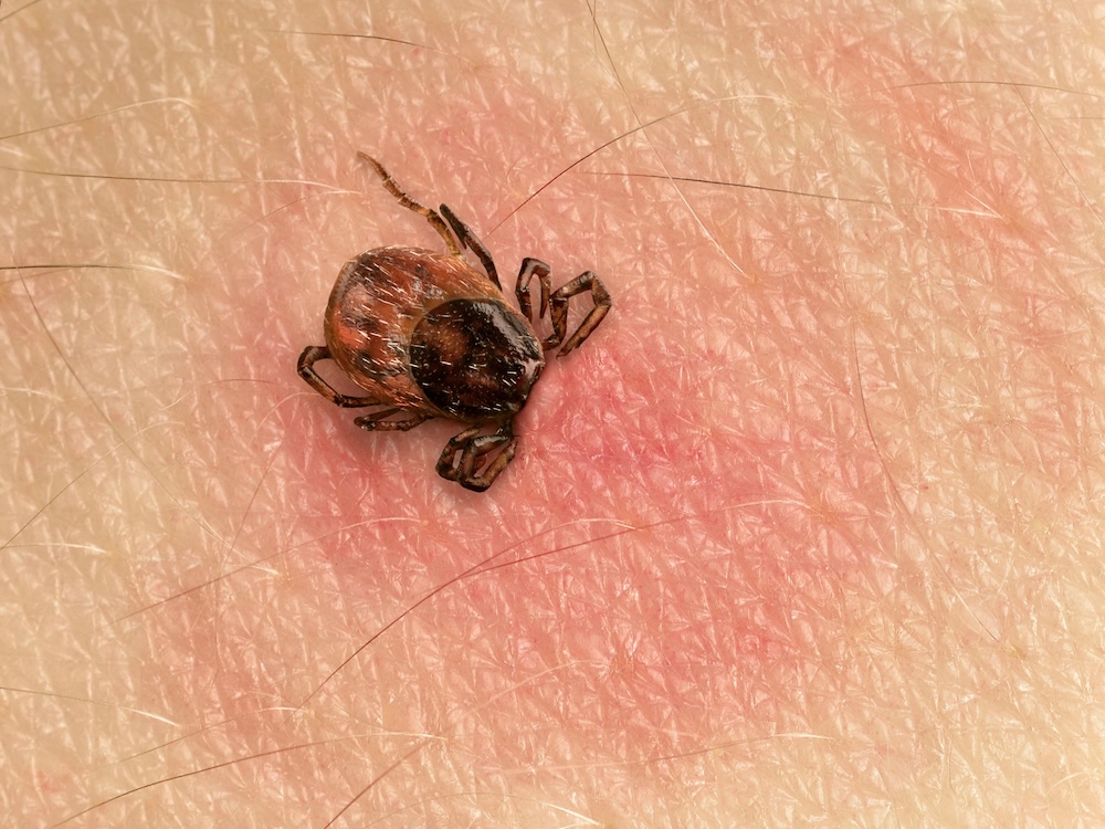 The Lyme Disease Lie